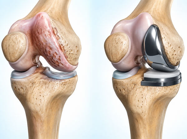 Advanced Orthopaedic Treatment Service