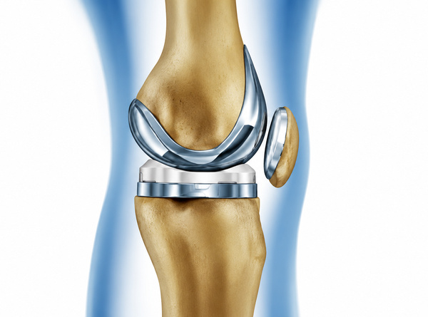 Best Partial Knee Replacement in Goregaon