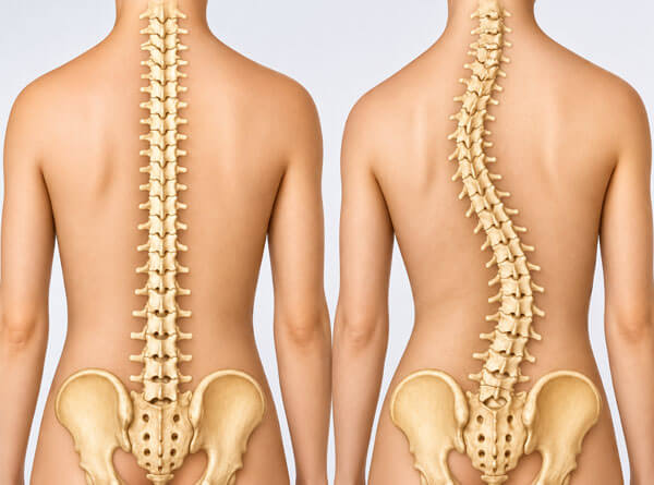 Deformity Correction Treatment Service
